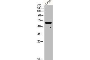 Western Blot analysis of COLO cells using CRF-RII Polyclonal Antibody (CRHR2 antibody  (Internal Region))