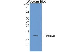 Detection of Recombinant GDF15, Rat using Polyclonal Antibody to Growth Differentiation Factor 15 (GDF15) (GDF15 antibody  (AA 189-303))