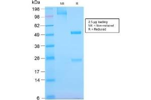 SDS-PAGE (SDS) image for anti-Epidermal Growth Factor Receptor (EGFR) antibody (ABIN6939297)