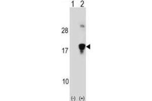 Western Blotting (WB) image for anti-High Mobility Group Nucleosomal Binding Domain 3 (HMGN3) antibody (ABIN2999006) (HMGN3 antibody)