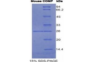 SDS-PAGE analysis of Mouse COMP Protein. (COMP Protein)