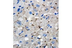 Anti-Connexin 40/GJA5 antibody, IHC(P) IHC(P): Rat Cardiac Muscle Tissue (Cx40/GJA5 antibody  (C-Term))