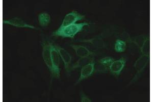 Immunocytochemistry (ICC) image for anti-alpha Tubulin (TUBA1) antibody (ABIN93894)