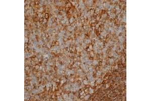 Immunohistochemistry (IHC) image for anti-CD44 (CD44) antibody (ABIN180800) (CD44 antibody)