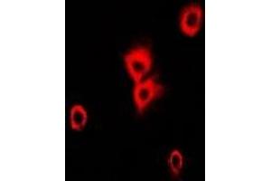 Immunofluorescent analysis of Alpha-tubulin 4a staining in Hela cells. (TUBA4A antibody)