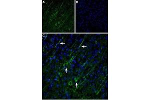 Expression of TRPC5 in rat cortex - Immunohistochemical staining of rat cortex using Anti-TRPC5 Antibody (ABIN7043823, ABIN7043974 and ABIN7043975). (TRPC5 antibody  (C-Term, Intracellular))