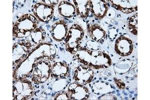 Immunohistochemical staining of paraffin-embedded liver tissue using anti-HSD17B10mouse monoclonal antibody. (HSD17B10 antibody)
