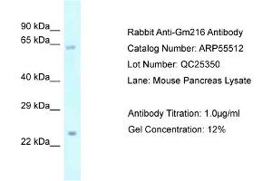 Western Blotting (WB) image for anti-Predicted Gene 216 (GM216) (Middle Region) antibody (ABIN2786243) (GM216 antibody  (Middle Region))