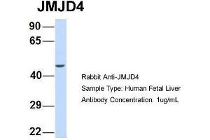 Host:  Rabbit  Target Name:  JMJD4  Sample Type:  Human Fetal Liver  Antibody Dilution:  1. (JMJD4 antibody  (N-Term))