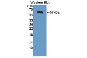 Detection of Recombinant LBP, Porcine using Polyclonal Antibody to Lipopolysaccharide Binding Protein (LBP) (LBP antibody  (AA 36-474))