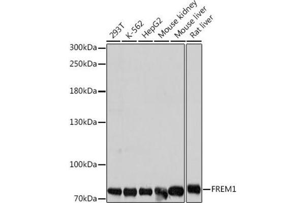 FREM1 antibody  (AA 1880-2179)