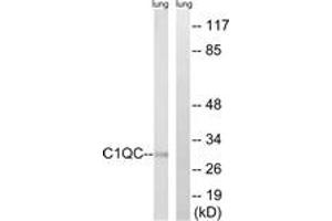 Western Blotting (WB) image for anti-Complement Component 1, Q Subcomponent, C Chain (C1QC) (AA 81-130) antibody (ABIN2890231) (C1QC antibody  (AA 81-130))