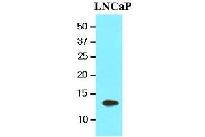 Cell lysates of LnitrocelluloseaP(20 ug) were resolved by SDS-PAGE, transferred to nitrocellulose membrane and probed with anti-human TBCA (1:1000). (TBCA antibody  (AA 1-108))