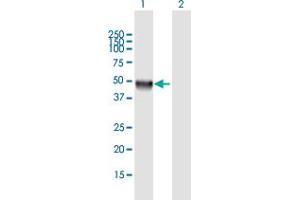 Western Blot analysis of CLN5 expression in transfected 293T cell line by CLN5 MaxPab polyclonal antibody. (CLN5 antibody  (AA 1-407))