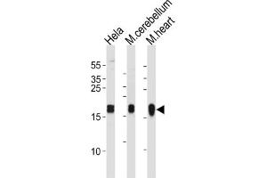 Western Blotting (WB) image for anti-NADH Dehydrogenase (Ubiquinone) Fe-S Protein 7, 20kDa (NADH-Coenzyme Q Reductase) (NDUFS7) antibody (ABIN3004675) (NDUFS7 antibody)