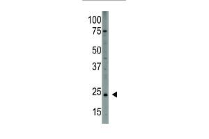 Antibody is used in Western blot to detect PDGFA in HL60 cell lysate. (PDGFA antibody  (N-Term))