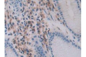 IHC-P analysis of Human Stomach Tissue, with DAB staining. (Chemerin antibody  (AA 33-158))