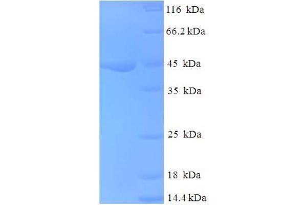 NDUFA6 Protein (AA 27-154, partial) (GST tag)