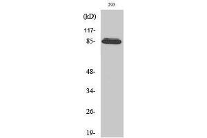 Western Blotting (WB) image for anti-ADAM Metallopeptidase Domain 32 (ADAM32) (Internal Region) antibody (ABIN3173675) (ADAM32 antibody  (Internal Region))