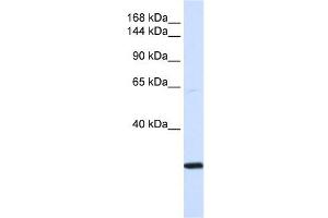 SMC2 antibody used at 1 ug/ml to detect target protein. (SMC2 antibody  (N-Term))