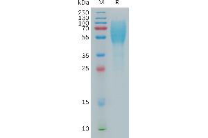 Human L Protein, His Tag on SDS-PAGE under reducing condition. (LAMP3 Protein (AA 28-381) (His tag))