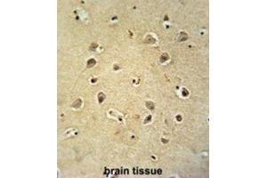 Immunohistochemistry (IHC) image for anti-gamma-aminobutyric Acid (GABA) A Receptor, gamma 2 (GABRG2) antibody (ABIN2995557) (GABRG2 antibody)