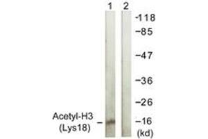 Western Blotting (WB) image for anti-Histone 3 (H3) (H3K18ac) antibody (ABIN2879163) (Histone 3 antibody  (H3K18ac))