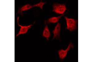 ABIN6267295 staining HeLa by IF/ICC. (HSP27 antibody  (pSer78))
