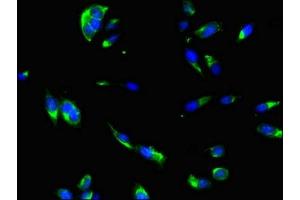 Immunofluorescent analysis of Hela cells using ABIN7166807 at dilution of 1:100 and Alexa Fluor 488-congugated AffiniPure Goat Anti-Rabbit IgG(H+L) (DNAJC6 antibody  (AA 201-500))