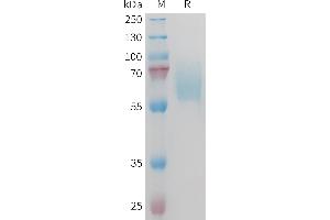 Mouse AXL Protein, His Tag on SDS-PAGE under reducing condition. (AXL Protein (AA 19-443) (His tag))