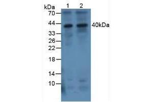 Figure. (IL-1 beta antibody  (AA 117-268))