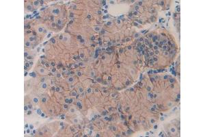 IHC-P analysis of Human Tissue, with DAB staining. (ERN1 antibody  (AA 571-832))