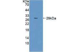 Detection of Recombinant SCO2, Human using Polyclonal Antibody to SCO Cytochrome Oxidase Deficient Homolog 2 (SCO2) (SCO2 antibody  (AA 42-266))
