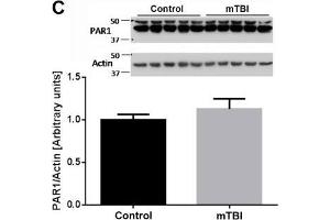 At two weeks upon injury, brain thrombin activity and concentration are similar between mTBI exposed animals and controls. (PAR1 antibody  (AA 251-350))