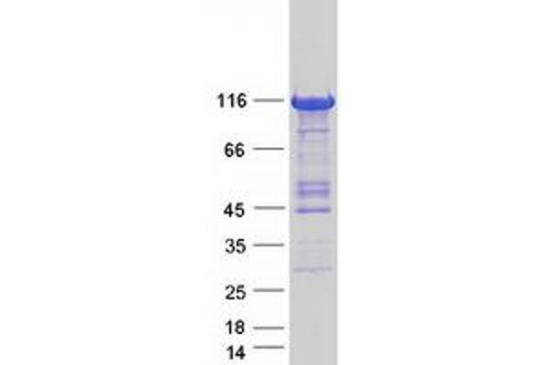 PHKA1 Protein (Transcript Variant 2) (Myc-DYKDDDDK Tag)