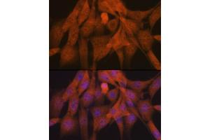 Immunofluorescence analysis of NIH-3T3 cells using K48-linkage Specific Ubiquitin Rabbit mAb (ABIN1680189, ABIN3017871, ABIN3017872 and ABIN7101530) at dilution of 1:100 (40x lens). (Ubiquitin B antibody)