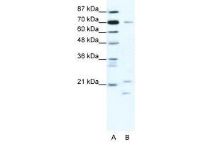 BTF3 antibody (20R-1189) used at 0. (BTF3 antibody  (Middle Region))