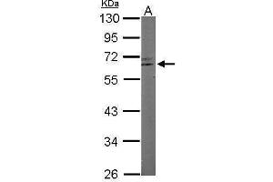 WB Image Sample (50 ug of whole cell lysate) A: Mouse brain 10% SDS PAGE antibody diluted at 1:1000 (RAP1 antibody  (Center))