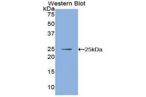 Western Blotting (WB) image for anti-Inhibitor of KB Kinase beta Interacting Protein (IKbIP) (AA 132-314) antibody (ABIN1859323) (IKbIP antibody  (AA 132-314))