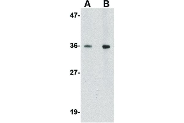 HAPLN2 antibody  (Internal Region)