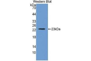 Western Blotting (WB) image for Thrombospondin 1 (THBS1) ELISA Kit (ABIN6574176)