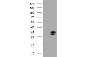 HEK293T cells were transfected with the pCMV6-ENTRY control (Left lane) or pCMV6-ENTRY QPRT (Right lane) cDNA for 48 hrs and lysed. (QPRT antibody)