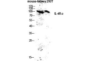 Western blot analysis of Mouse-kidney, 293T lysate using IL-4Rα antibody. (IL4 Receptor antibody)