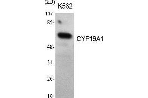 Western Blot analysis of various cells using CYP19A1 Polyclonal Antibody diluted at 1:1000. (Aromatase antibody  (AA 190-270))