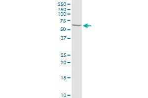 PRLR MaxPab rabbit polyclonal antibody. (Prolactin Receptor antibody  (AA 1-622))