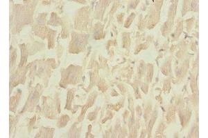 Immunohistochemistry of paraffin-embedded human heart tissue using ABIN7149412 at dilution of 1:100 (PLA2G4C antibody  (AA 1-189))