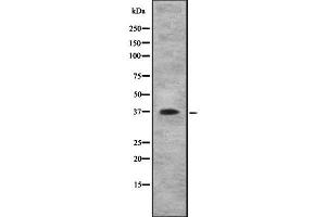 Western blot analysis IL10RB using COLO205 whole cell lysates (IL10RB antibody  (C-Term))