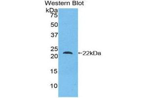 Western Blotting (WB) image for anti-Mesencephalic Astrocyte-Derived Neurotrophic Factor (MANF) (AA 28-182) antibody (ABIN1859738) (MANF antibody  (AA 28-182))