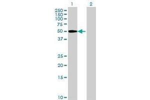 Lane 1: TMEM175 transfected lysate ( 55. (MGC4618 293T Cell Transient Overexpression Lysate(Denatured))