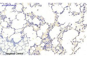 Immunohistochemical analysis of paraffin-embedded rat lung tissue. (JAK1 antibody  (pTyr1022))